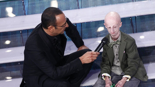Muore Sammy Basso che rese visibile la sindrome dell invecchiamento