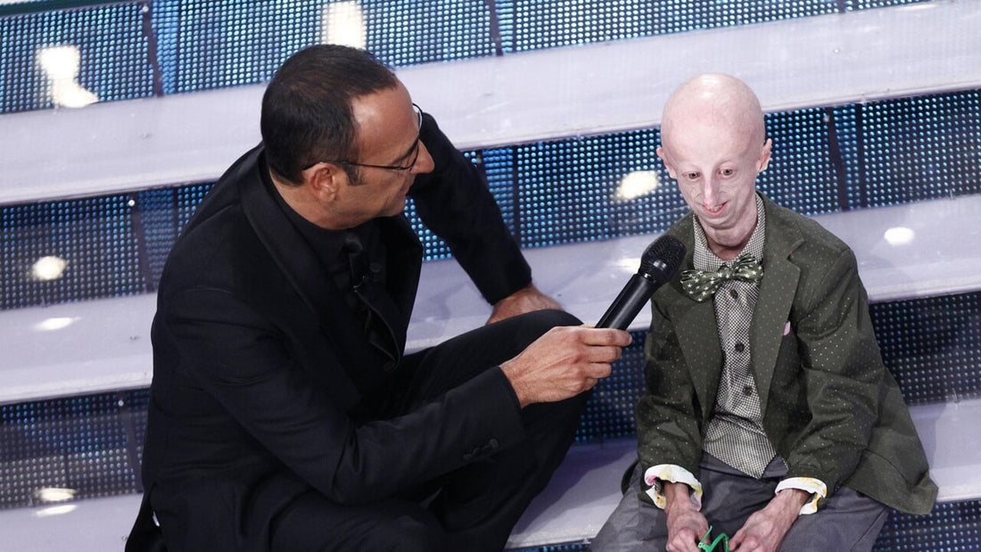 Muore Sammy Basso che rese visibile la sindrome dell invecchiamento